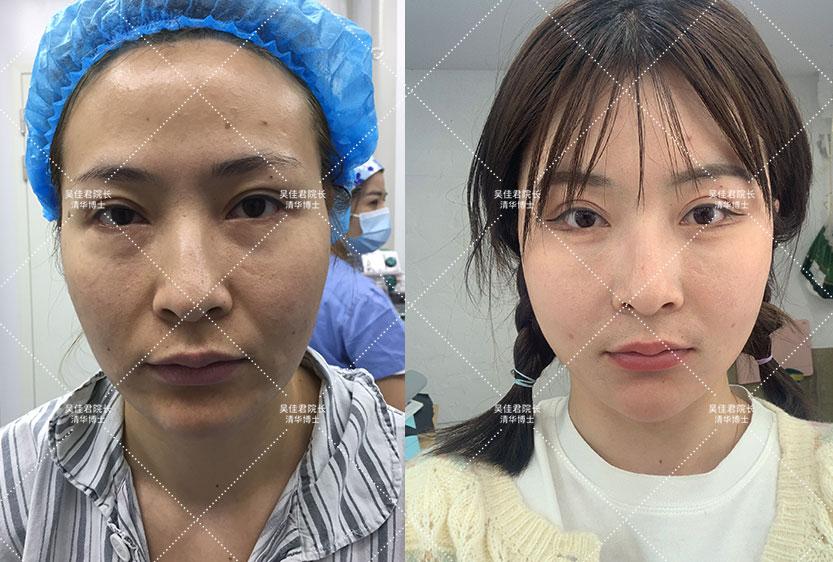 运城_四肖八码精准100%免费公开,哄骗档案的全面释义、解释与落实